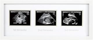 Pearhead 87038 Trimester Sonogram Frame Deluxe, fotoğraf çerçevesi için üç Ultraschallaufnahmen, beyaz